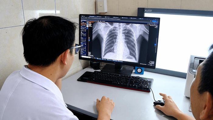 Dữ liệu hình ảnh được số hóa, hỗ trợ bác sĩ trong quá trình đọc phim và chẩn đoán, nâng cao hiệu quả khám, chữa bệnh. Ảnh: Đỗ Duẩn