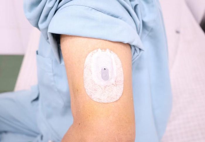 CGM theo dõi đường huyết - Ảnh BVCC