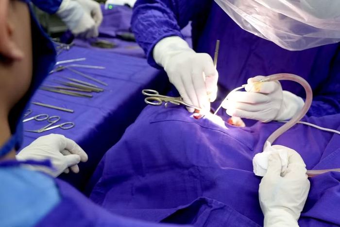 Trường hợp bé trai 9 tuổi là một ví dụ. Từ một viên bi nhỏ mắc ở tai, việc trẻ tự móc khiến dị vật đi sâu qua màng nhĩ, nằm trong hòm nhĩ và gây tổn thương chuỗi xương con. Ảnh: Bệnh viện cung cấp