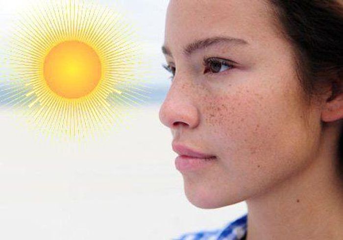 Da sạm đi khi tiếp xúc với nắng nhiều. Ảnh minh họa