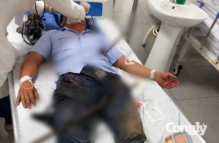 Bệnh nhân vào viện trong tình trạng nguy kịch vì bị hai thanh sắt đâm xuyên qua người