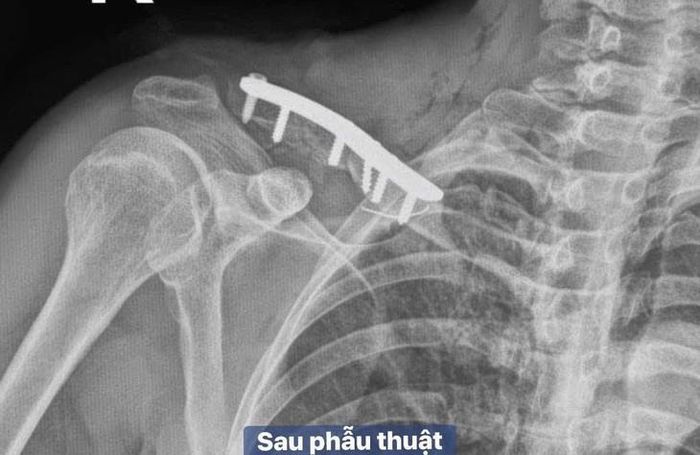 Hình ảnh trước và sau khi phẫu thuật. Ảnh: Nhật Thắng.