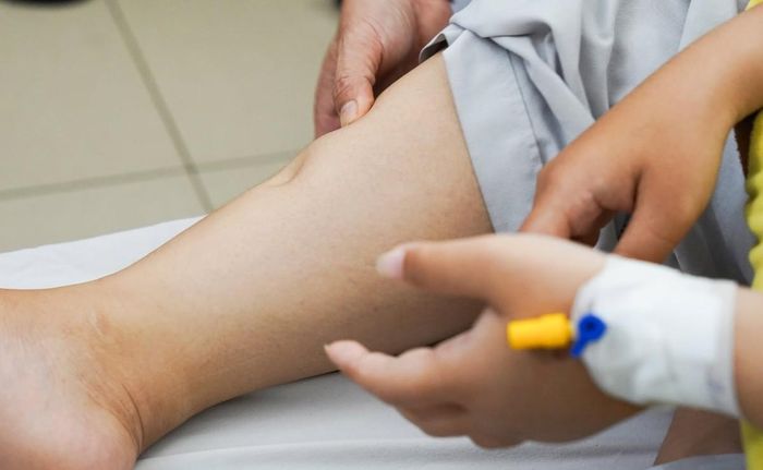 PGS.TS. Nguyễn Bách cho biết: “Giai đoạn sớm, chi phí điều trị chưa tới 1 triệu đồng/tháng. Nhưng khi vào giai đoạn ba, bốn, con số này tăng lên 6 – 9 triệu đồng, chưa kể lọc máu. Đó là gánh nặng khủng khiếp với người bệnh và cả hệ thống y tế”. Ảnh: Bệnh viện Thống Nhất