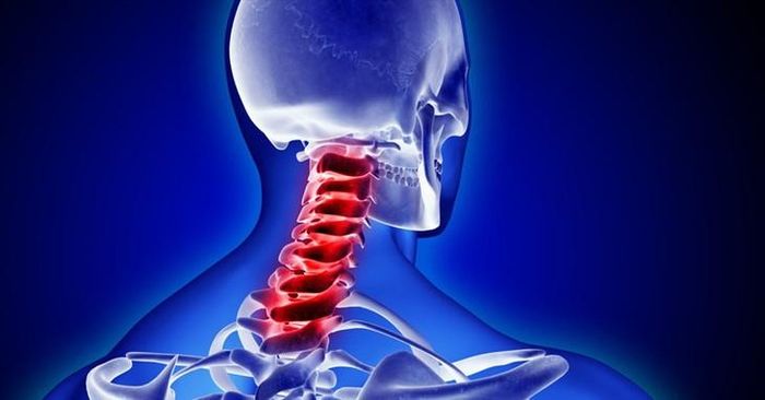 Đau mỏi cổ, vai gáy là những triệu chứng khá phổ biến, đặc biệt ở người làm việc lâu với máy tính, ít vận động. Ảnh AI