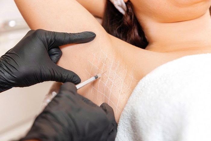 Tiêm botulinum toxin có thể được sử dụng để giảm tiết mồ hôi, từ đó hỗ trợ kiểm soát mùi cơ thể ở người mắc bromhidrosis. Ảnh: Steklo_KRD.