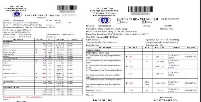 Kết quả khám lại sau 1 tháng các chỉ số vàng da giảm, men gan về bình thường, đông máu về bình thường -Ảnh BVCC