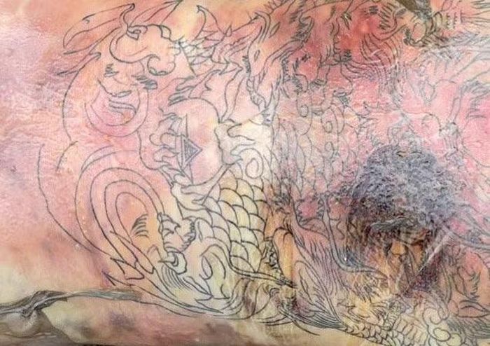 Trên lưng nạn nhân có xăm hình con rồng phủ kín.