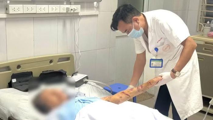 Các bác sĩ tiến hành vệ sinh vết thương cho bệnh nhân do chó cắn