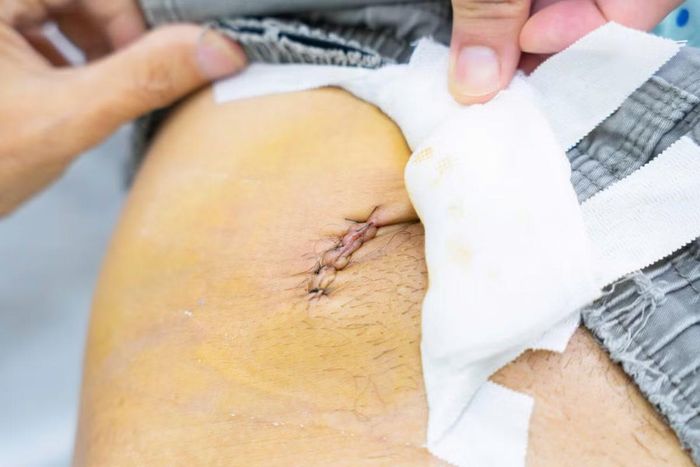 Bác sĩ thăm khám vết thương cho bệnh nhân sau can thiệp - Ảnh BVCC