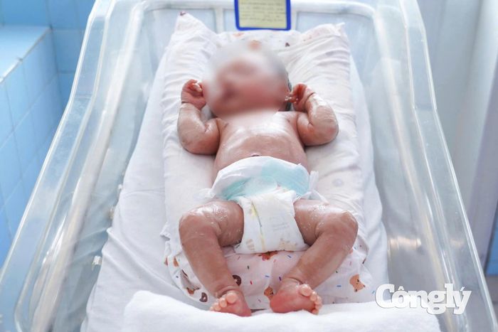 Bé sinh non mắc vảy cá hiếm gặp được các bác sĩ điều trị thành công.