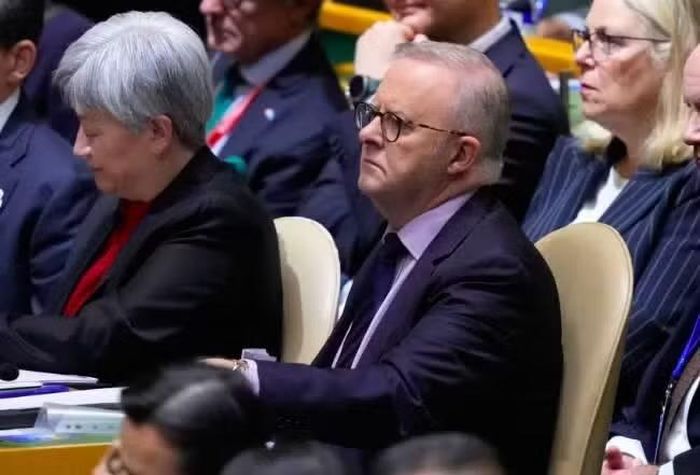 Thủ tướng Úc Anthony Albanese dự phiên thảo luận cấp cao Đại hội đồng LHQ ngày 22-9. Ảnh: AP