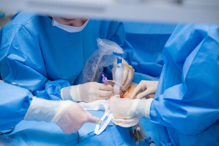 Truyền máu trong tử cung là một kỹ thuật đặc biệt. Kim phải được đưa đúng vị trí, lượng máu phải phù hợp và thai phải được theo dõi rất chặt chẽ.