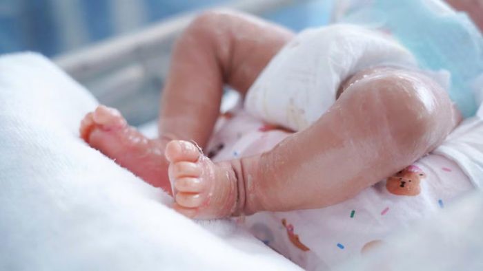 Tình trạng sức khỏe của bé đã cải thiện tích cực. (Ảnh: CTV)