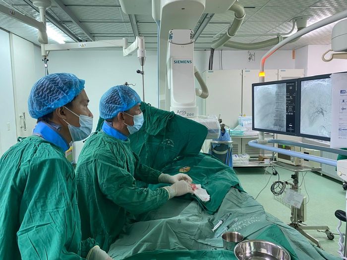 BS Nguyễn Quang Châu Phú cùng Ê-kíp can thiệp nút mạch cầm máu u gan vỡ cho bệnh nhân Thái Đình B. (80 tuổi) vào ngày 12/8/2026 – một ngày sau đợt truyền hóa chất thứ 5.