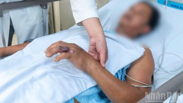 Ông T. được điều trị tích cực tại bệnh viện. (Ảnh: Bệnh viện cung cấp)