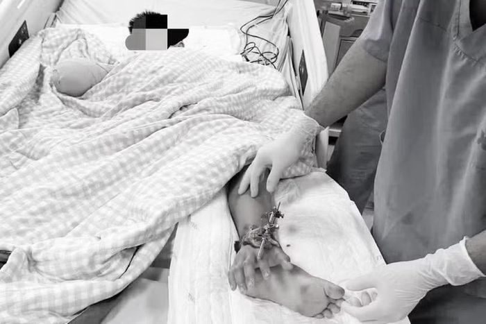 Ê-kíp phẫu thuật đã thực hiện kỹ thuật nối bàn tay vào hệ thống mạch máu ở cẳng chân để tạm thời duy trì sự sống. (Ảnh: người nhà cung cấp).