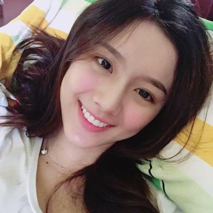 Khánh Linh ngày xưa gây chú ý với hành trình niềng răng. Ảnh: FBNV.