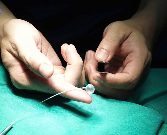 Quả bóng "đặc biệt" được sử dụng cứu thai nhi.