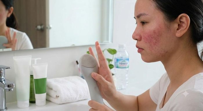 Tránh sử dụng các loại máy rửa mặt hay dụng cụ cọ xát cơ học lên vùng da mặt. Ảnh minh họa