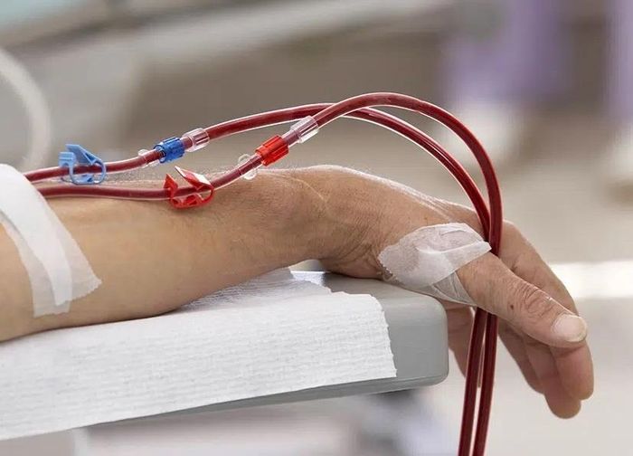 Khi thận mất khả năng hoạt động hiệu quả, hàng loạt chức năng trong cơ thể có thể bị xáo trộn. Ảnh: Projectcbd.