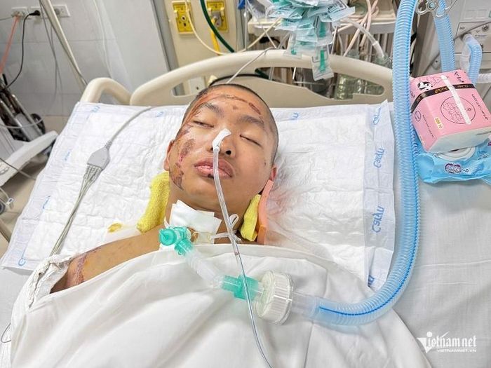 Bao năm qua Hoàng phải chống chọi với bệnh suy thận, nay không may bị tai nạn