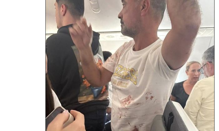 Áo một hành khách dính máu sau vụ việc - Ảnh: Daily Mail