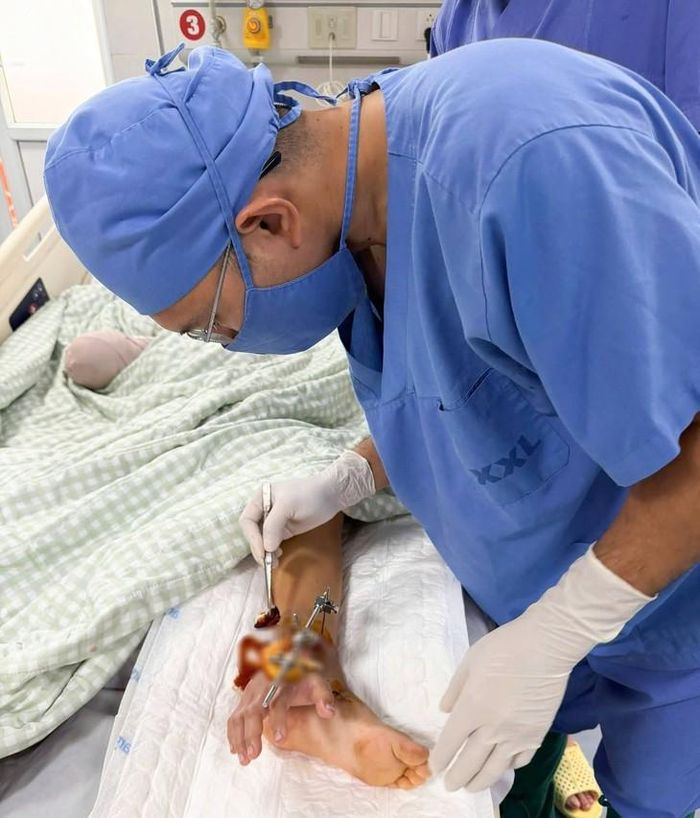 Bác sĩ kiểm tra bàn tay bị đứt lìa nối tạm vào cổ chân.
