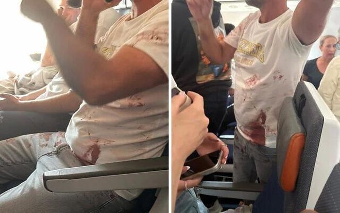 Hình ảnh một hành khách mặc áo dính máu trên chuyến bay của flydubai từ Dubai đến Tel Aviv gặp sự cố khẩn cấp giữa không trung. Ảnh: Times of Israel.