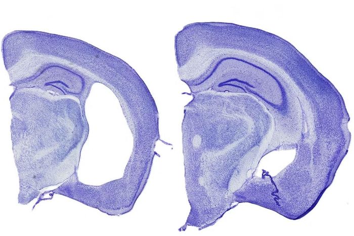 Hình ảnh não chuột bị tổn thương mô điển hình của thoái hóa thần kinh giống bệnh Alzheimer (trái) và hình ảnh phản ứng miễn dịch có hại đã được ngăn chặn.
