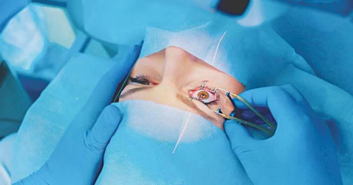 Hàng trăm nghìn người trải qua phẫu thuật mắt bằng laser mỗi năm, nhưng các nhà nghiên cứu hy vọng sẽ thay đổi điều đó.