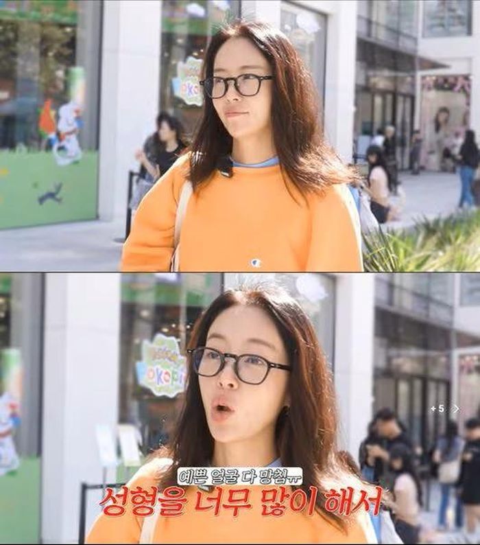 Hwang Jung Eum nói về việc phẫu thuật thẩm mỹ.