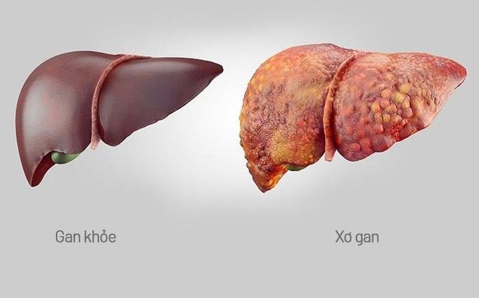 Gan giống như một "nhà máy hóa chất" của cơ thể. Ảnh M.H