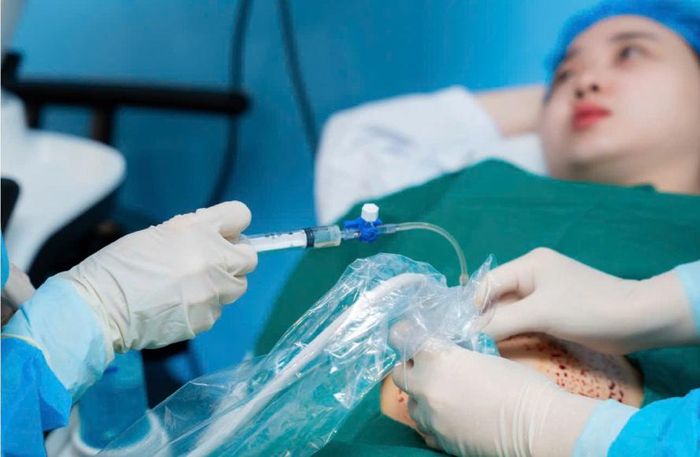 Lần chọc ối lúc thai 16 tuần. Ảnh: BSCC.