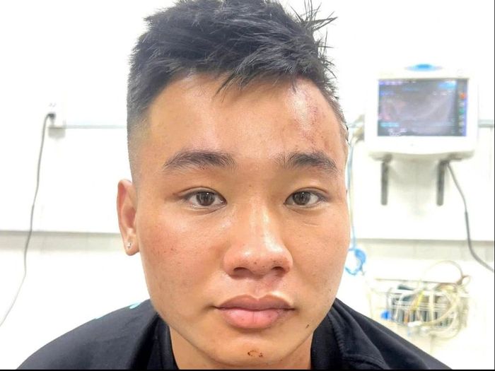 Nghi phạm Nguyễn Đức Anh. Ảnh: CA.