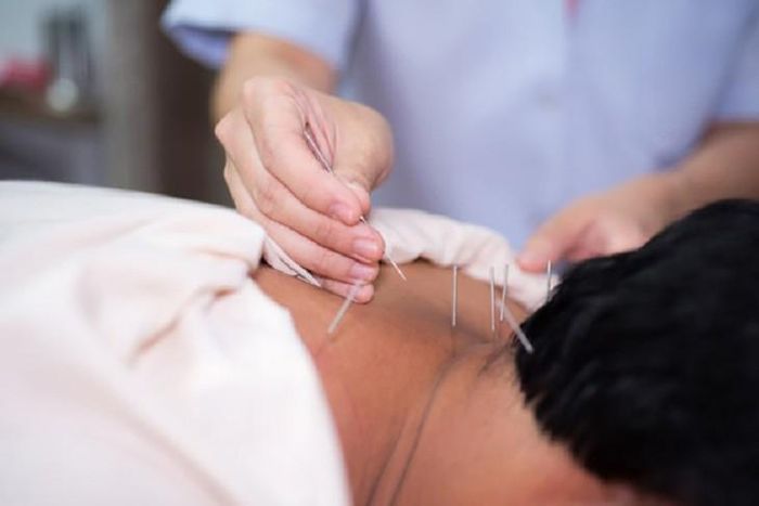 Kết hợp châm cứu với phục hồi chức năng, hỗ trợ nâng cao hiệu quả điều trị
