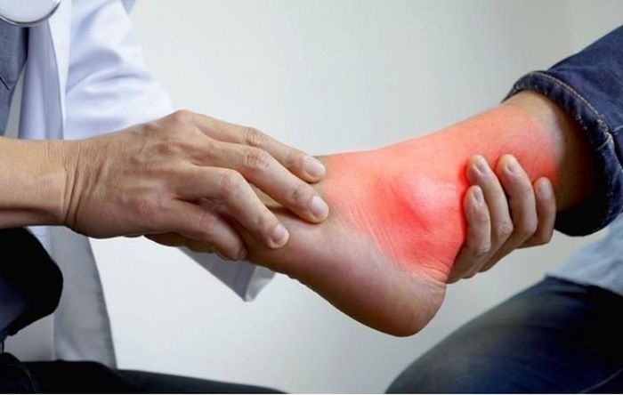 Cơ địa di truyền, khả năng đào thải acid uric của thận, bệnh lý chuyển hóa, thuốc đang sử dụng, rượu bia và cân nặng đều có thể góp phần vào quá trình hình thành bệnh. Ảnh M.H