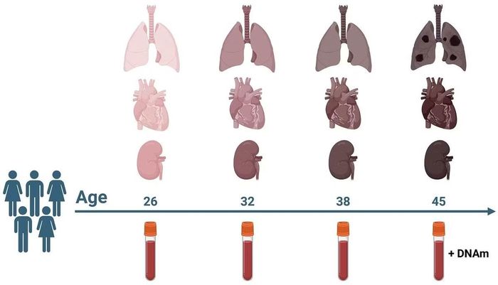 Trước nay, việc cấy ghép tạng được thực hiện trong một giới hạn độ tuổi nhất định.