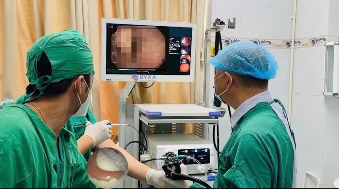 Bác sĩ nội soi gắp hàm răng giả cho bệnh nhân - Ảnh BVCC