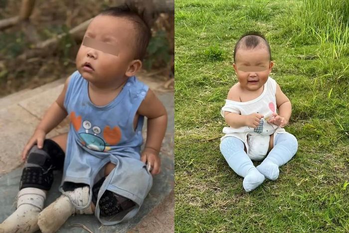 Cậu bé Wenwen đeo đồ bảo vệ đầu gối khi chơi ngoài trời. Ảnh: Sohu