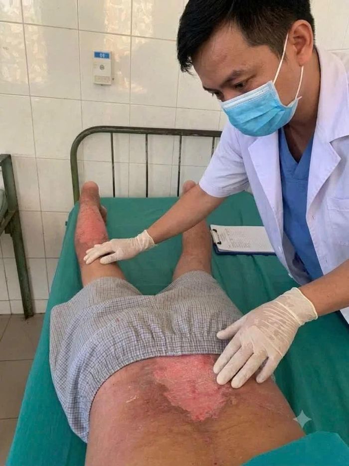 Sau điều trị, các tổn thương da của bệnh nhân đã hồi phục.