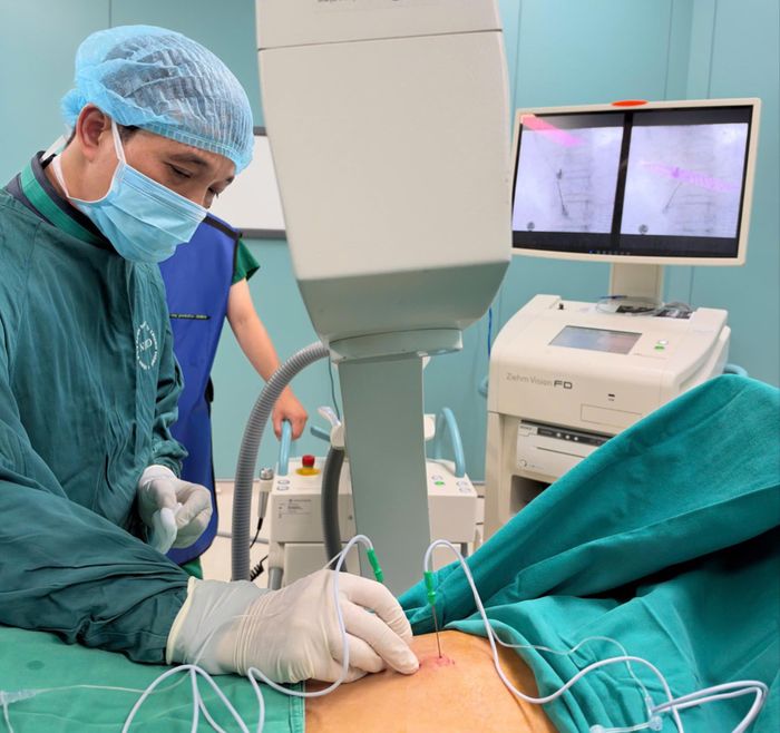 Kỹ thuật sóng cao hỗ trợ giảm cơn đau sau zona kéo dài. Ảnh: Thanh Nguyễn