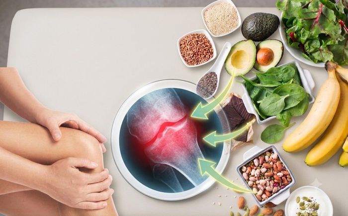 Dinh dưỡng và lối sống đóng vai trò quan trọng trong việc bảo vệ sức khỏe cơ xương khớp. Ảnh AI.