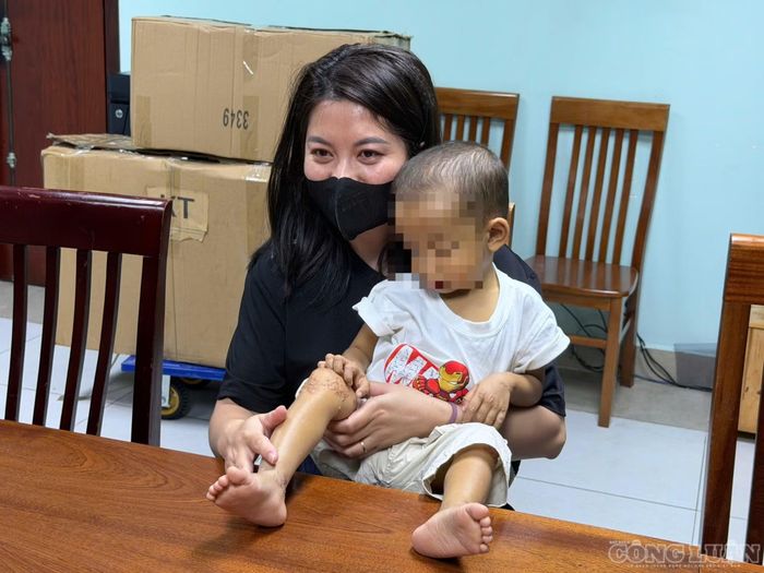 Những tổn thương này gây ngứa dữ dội, khiến trẻ mất ngủ, ảnh hưởng đến sinh hoạt và phát triển. Tuy nhiên, bác sĩ Hoa nhấn mạnh xanthoma không phải bệnh truyền nhiễm và hội chứng Alagille không lây từ trẻ này sang trẻ khác. “Bệnh này không lây”, bác sĩ nói. Theo bác sĩ, chính những biểu hiện bên ngoài như vàng da, xanthoma, khuôn mặt đặc trưng hoặc thể trạng nhỏ bé khiến trẻ dễ bị chú ý, thậm chí bị xa lánh nếu những người xung quanh không hiểu về bệnh.