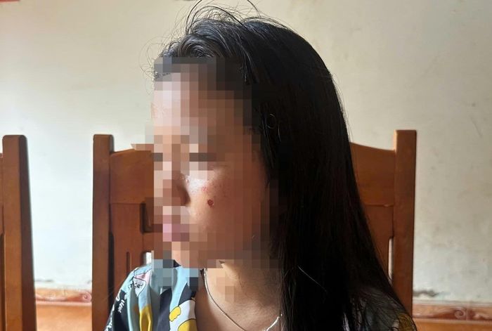 Nữ sinh lớp 10 chưa hết sợ hãi sau khi bị bạn bạo hành.