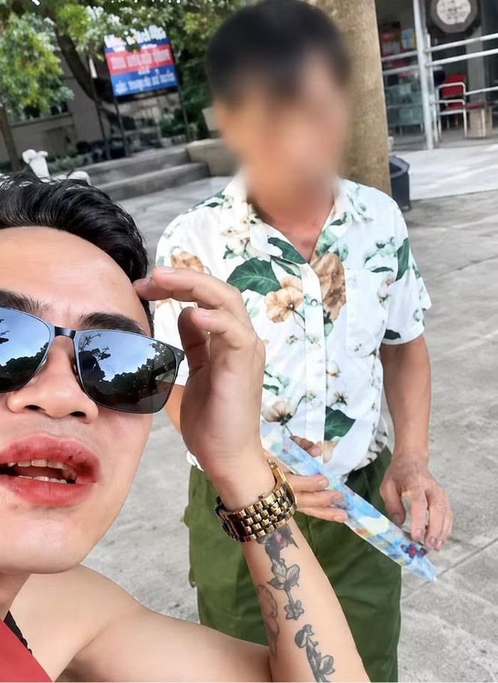  Thắng "Ật" trong video khiêu khích bảo vệ nhà hàng Cường Dê. 
