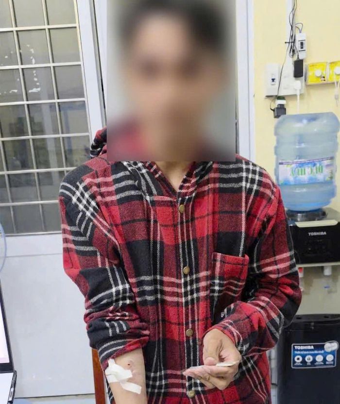 Anh N.V.K cùng con dao tự gây thương tích cho bản thân rồi đến Công an xã Khánh Bình trình báo bị cướp. Ảnh: Tiến Tầm