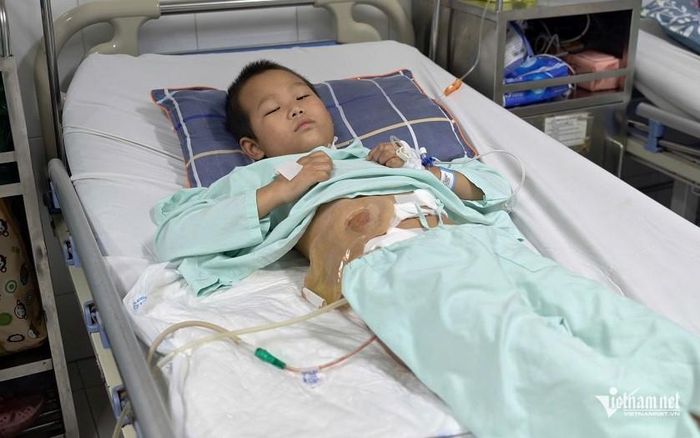 Theo đánh giá của các bác sĩ, Pàng có khả năng phải tiếp tục phẫu thuật lần thứ ba. Tuy nhiên, số tiền gia đình dành dụm cho Pàng điều trị đang ngày một cạn dần