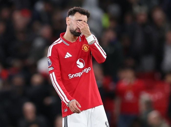 Bruno Fernandes gây thất vọng trước Tottenham. Ảnh: EPA