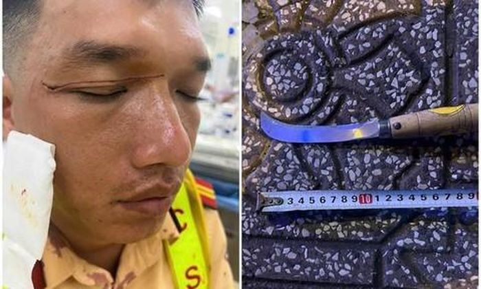 Cán bộ CSGT bị đối tượng Hào tấn công gây thương tích và con dao gây án
