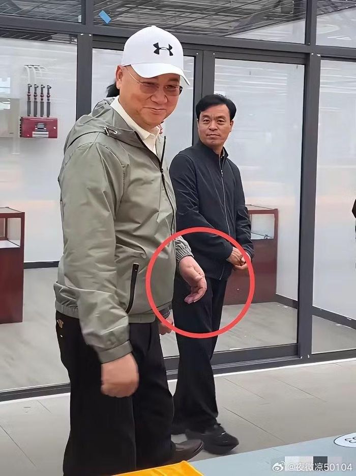 Bàn tay đơ cứng của nam nghệ sĩ gây bàn tán.